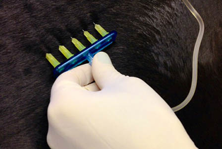 mesotherapy mesotherapy