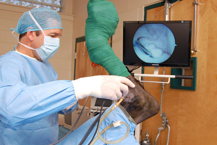 Performing surgery