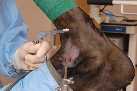 Laparoscopy - a minimally invasive surgical technique